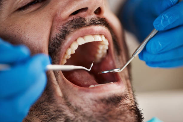 Best Emergency Dental Care for Sports Injuries in Hunter, OH